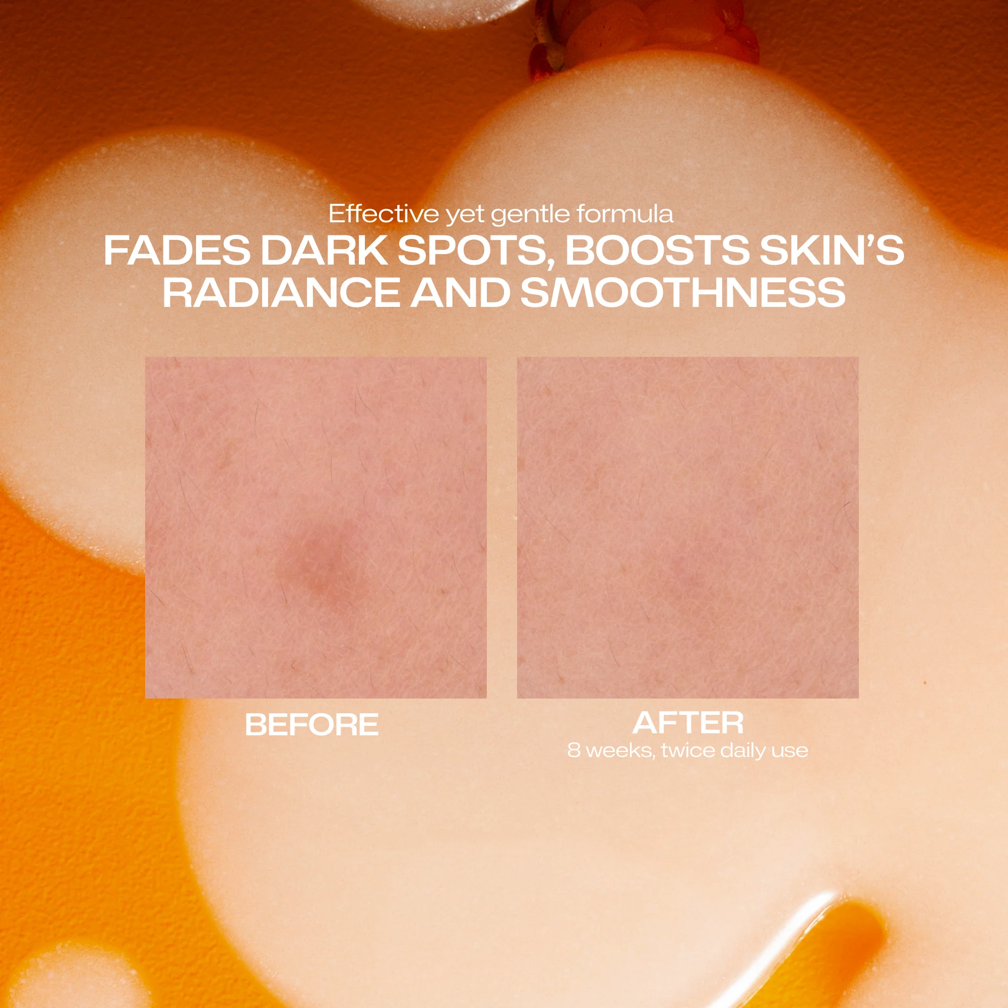 Dark Spot Serum - Image 7